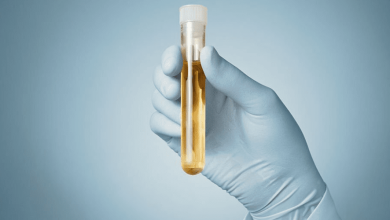revolutionizing-drug-screening:-unveiling-12-panel-now's-18-panel-urine-test